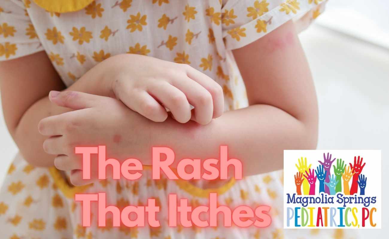 Kids Health Eastern Shore Parents Rash April 2023